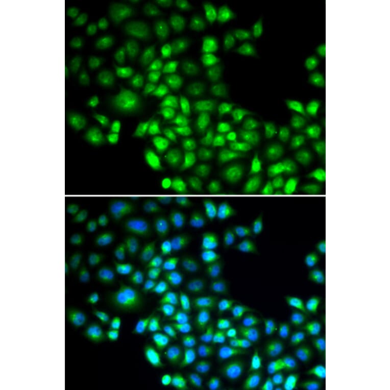 Immunofluorescence - FOXP1 antibody from Signalway Antibody (38637) - Antibodies.com