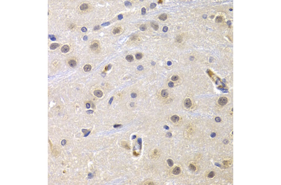 Immunohistochemistry - CCNG1 antibody from Signalway Antibody (38639) - Antibodies.com