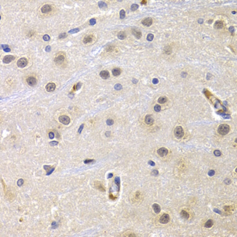 Immunohistochemistry - CCNG1 antibody from Signalway Antibody (38639) - Antibodies.com