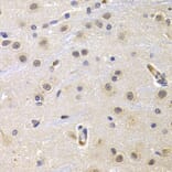 Immunohistochemistry - CCNG1 antibody from Signalway Antibody (38639) - Antibodies.com