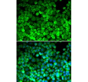 Immunofluorescence - TERF1 antibody from Signalway Antibody (38640) - Antibodies.com