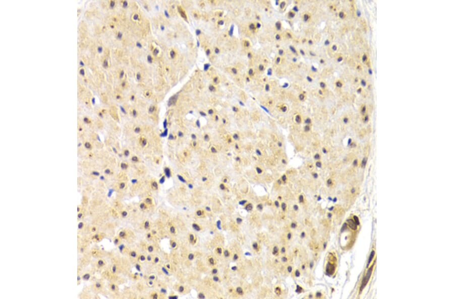 Immunohistochemistry - TERF1 antibody from Signalway Antibody (38640) - Antibodies.com