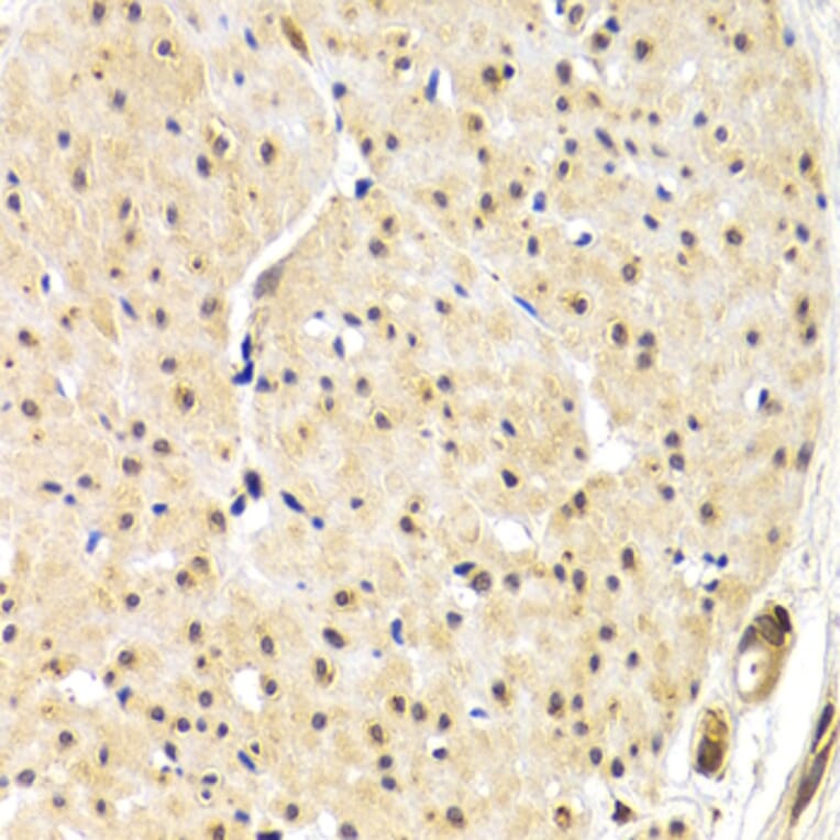 Immunohistochemistry - TERF1 antibody from Signalway Antibody (38640) - Antibodies.com