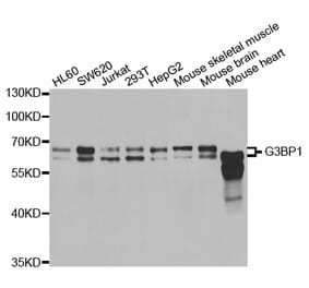 Western blot - G3BP1 antibody from Signalway Antibody (38645) - Antibodies.com
