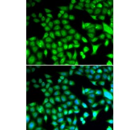 Immunofluorescence - FOSL1 antibody from Signalway Antibody (38646) - Antibodies.com