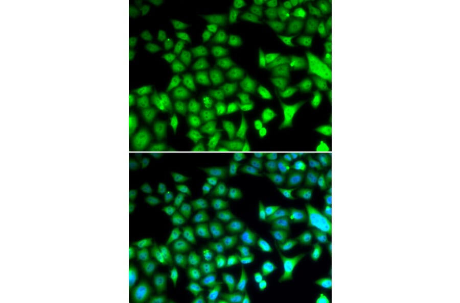Immunofluorescence - FOSL1 antibody from Signalway Antibody (38646) - Antibodies.com