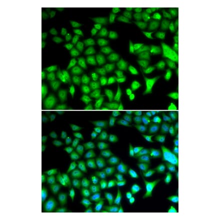 Immunofluorescence - FOSL1 antibody from Signalway Antibody (38646) - Antibodies.com