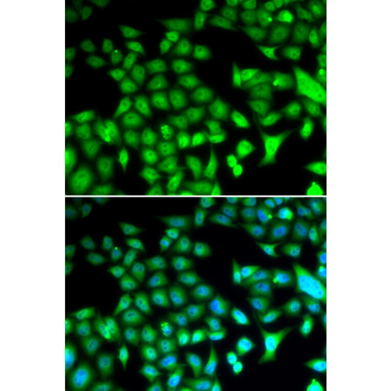 Immunofluorescence - FOSL1 antibody from Signalway Antibody (38646) - Antibodies.com