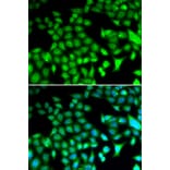 Immunofluorescence - FOSL1 antibody from Signalway Antibody (38646) - Antibodies.com