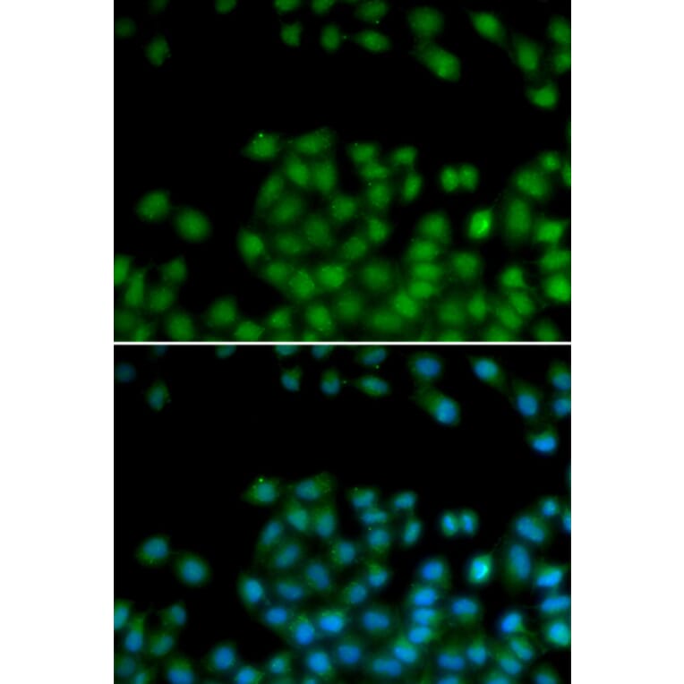 Immunofluorescence - SFRP2 antibody from Signalway Antibody (38648) - Antibodies.com