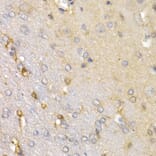 Immunohistochemistry - SFRP2 antibody from Signalway Antibody (38648) - Antibodies.com