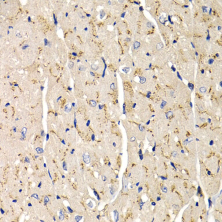 Immunohistochemistry - SFRP2 antibody from Signalway Antibody (38648) - Antibodies.com