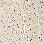 Immunohistochemistry - SFRP2 antibody from Signalway Antibody (38648) - Antibodies.com