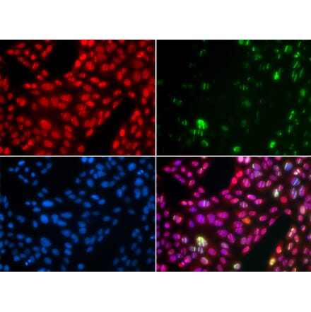 Immunofluorescence - CUL4B antibody from Signalway Antibody (38650) - Antibodies.com