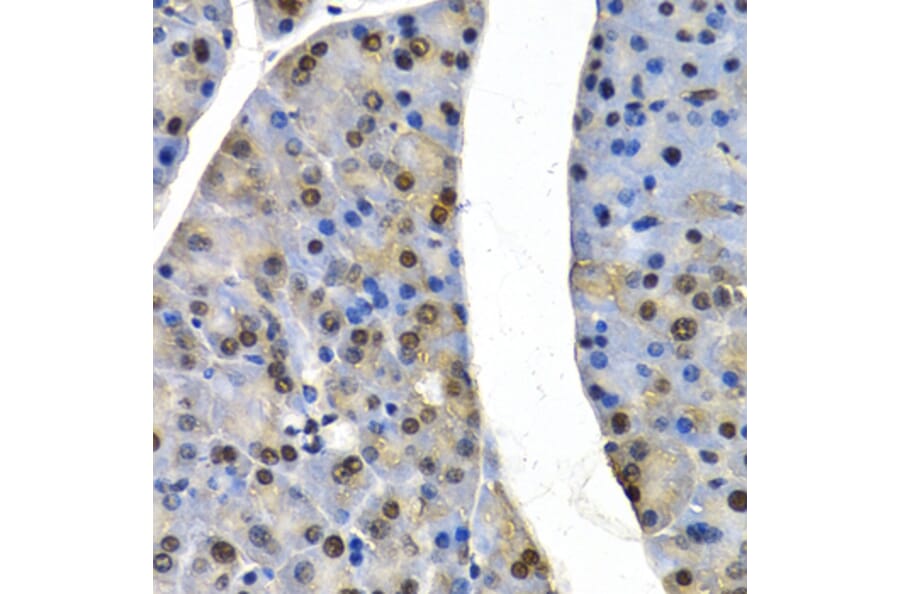 Immunohistochemistry - CUL4B antibody from Signalway Antibody (38650) - Antibodies.com