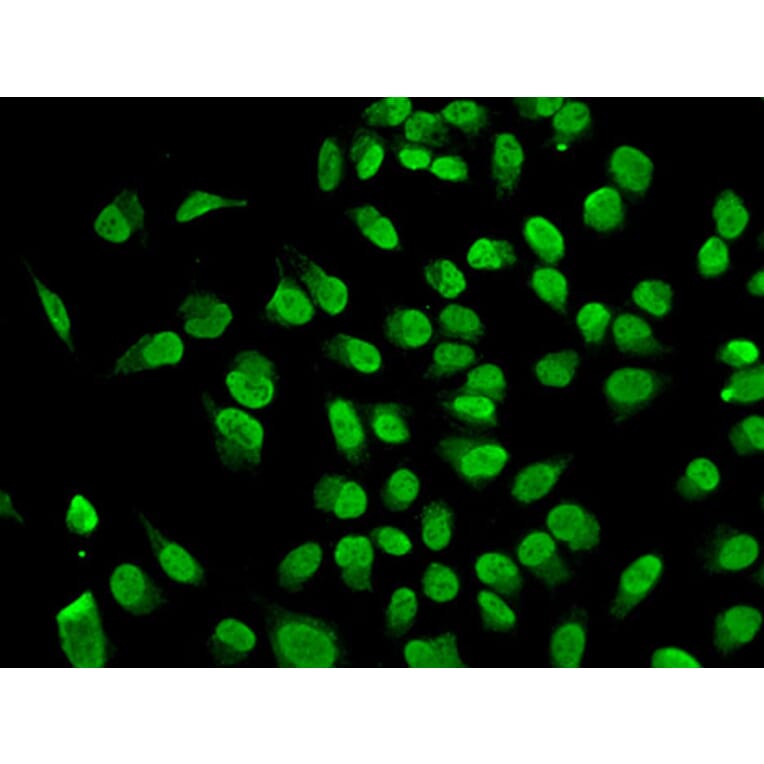 Immunofluorescence - Dnmt1 antibody from Signalway Antibody (38665) - Antibodies.com