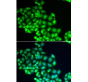 Immunofluorescence - ERCC2 antibody from Signalway Antibody (38678) - Antibodies.com