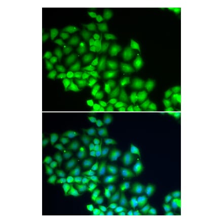 Immunofluorescence - ERCC2 antibody from Signalway Antibody (38678) - Antibodies.com