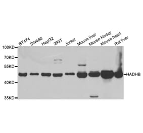 Western blot - HADHB antibody from Signalway Antibody (38684) - Antibodies.com