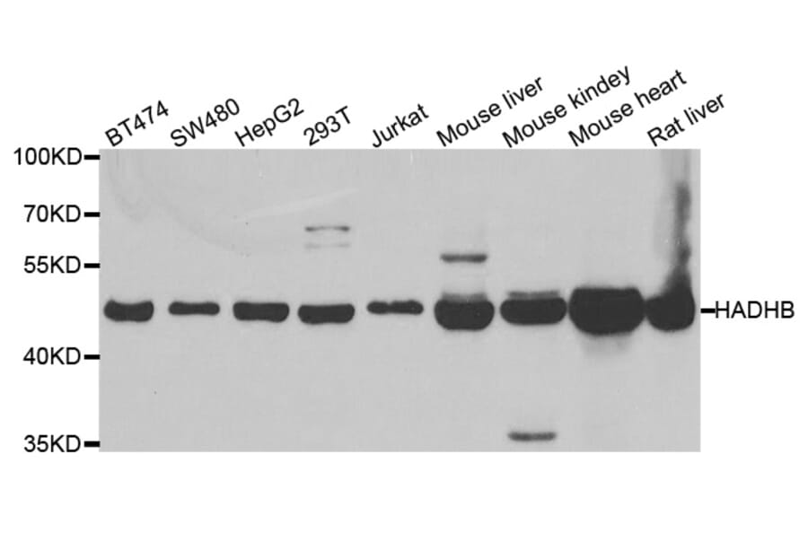 Western blot - HADHB antibody from Signalway Antibody (38684) - Antibodies.com