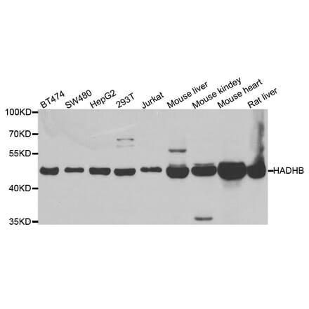 Western blot - HADHB antibody from Signalway Antibody (38684) - Antibodies.com