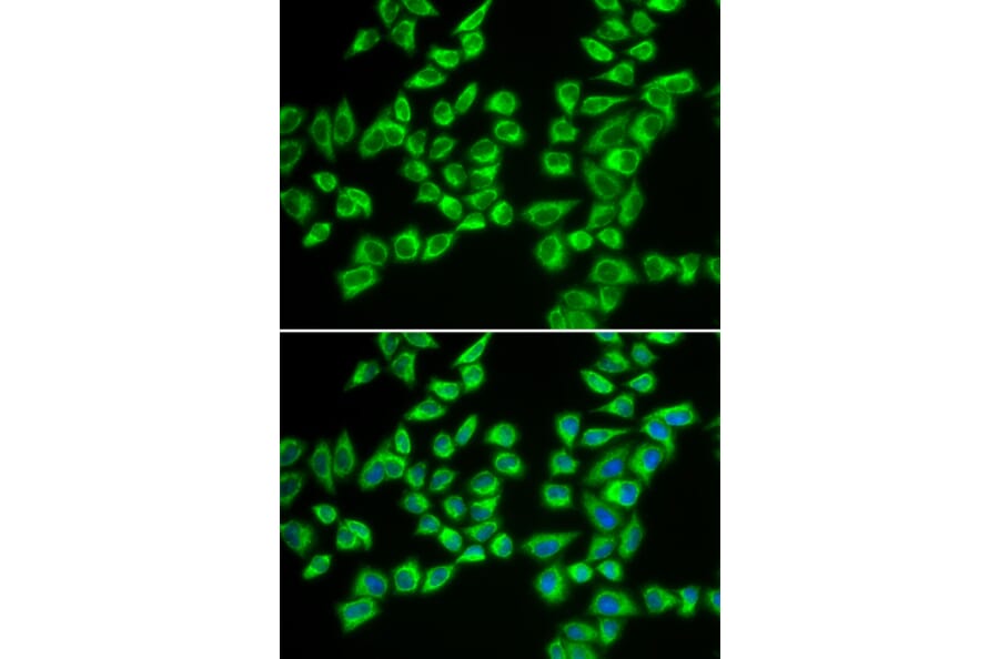 Immunofluorescence - HADHB antibody from Signalway Antibody (38684) - Antibodies.com