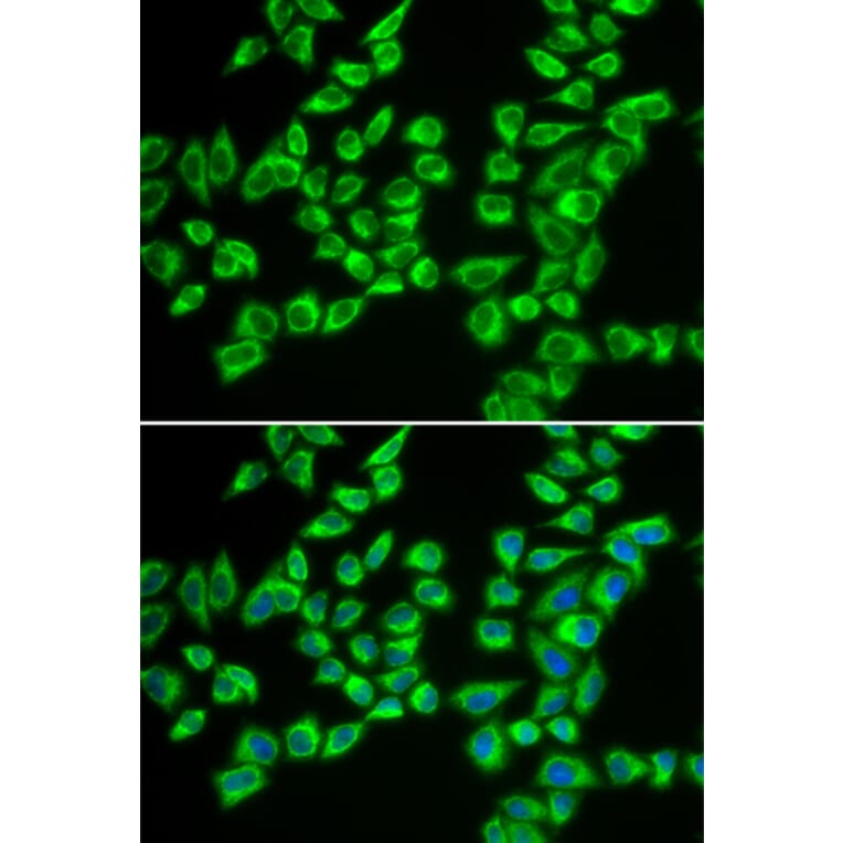 Immunofluorescence - HADHB antibody from Signalway Antibody (38684) - Antibodies.com