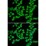 Immunofluorescence - HADHB antibody from Signalway Antibody (38684) - Antibodies.com
