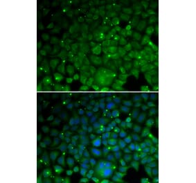 Immunofluorescence - CRYAA antibody from Signalway Antibody (38686) - Antibodies.com