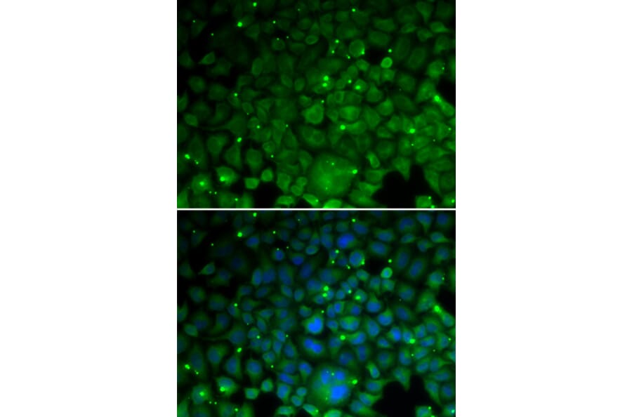 Immunofluorescence - CRYAA antibody from Signalway Antibody (38686) - Antibodies.com