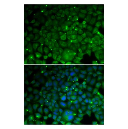 Immunofluorescence - CRYAA antibody from Signalway Antibody (38686) - Antibodies.com