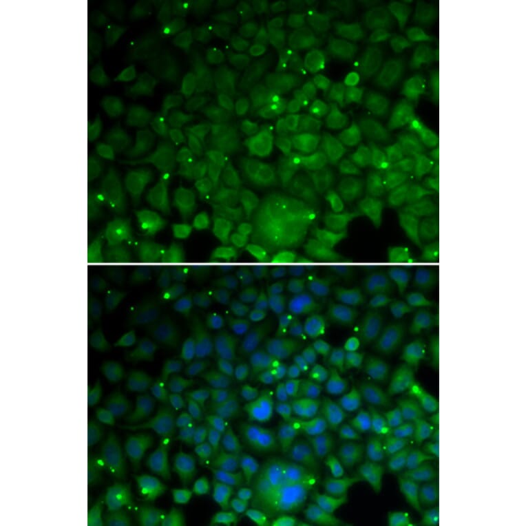 Immunofluorescence - CRYAA antibody from Signalway Antibody (38686) - Antibodies.com