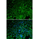 Immunofluorescence - CRYAA antibody from Signalway Antibody (38686) - Antibodies.com