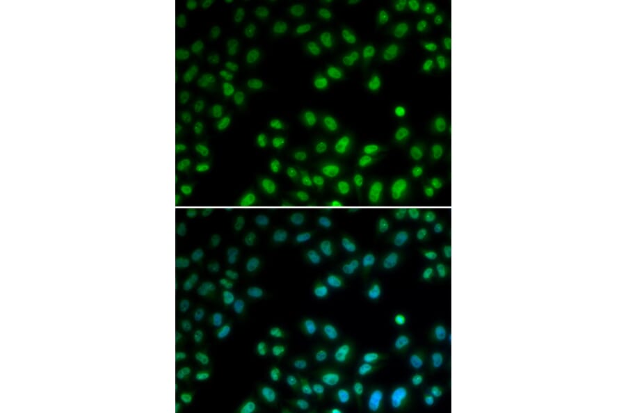 Immunofluorescence - PIAS1 antibody from Signalway Antibody (38687) - Antibodies.com