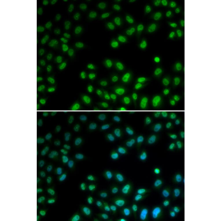 Immunofluorescence - PIAS1 antibody from Signalway Antibody (38687) - Antibodies.com