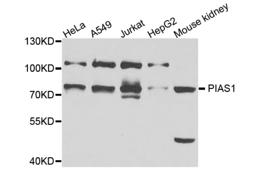 Western blot - PIAS1 antibody from Signalway Antibody (38687) - Antibodies.com
