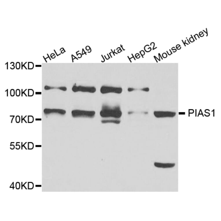 Western blot - PIAS1 antibody from Signalway Antibody (38687) - Antibodies.com