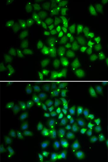 Immunofluorescence analysis of HeLa cell using PCGF6 antibody. Blue: DAPI for nuclear staining.