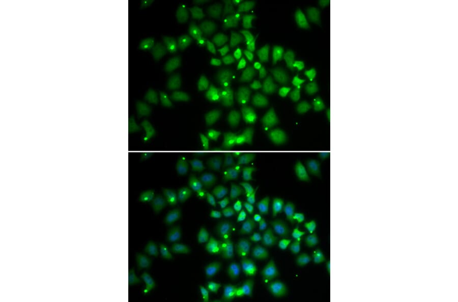 Immunofluorescence - PCGF6 antibody from Signalway Antibody (38689) - Antibodies.com