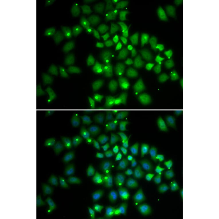Immunofluorescence - PCGF6 antibody from Signalway Antibody (38689) - Antibodies.com