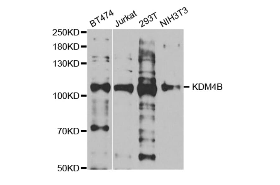 Western blot - KDM4B antibody from Signalway Antibody (38693) - Antibodies.com