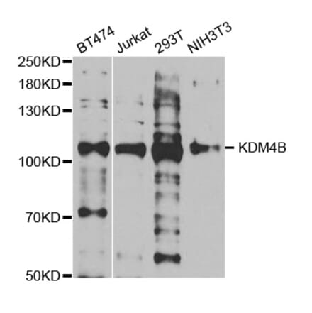 Western blot - KDM4B antibody from Signalway Antibody (38693) - Antibodies.com