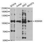 Western blot - KDM4B antibody from Signalway Antibody (38693) - Antibodies.com
