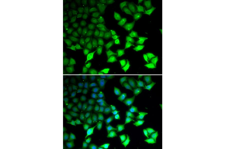 Immunofluorescence - KDM4B antibody from Signalway Antibody (38693) - Antibodies.com