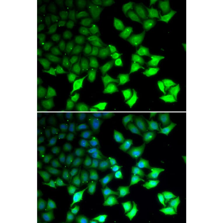 Immunofluorescence - KDM4B antibody from Signalway Antibody (38693) - Antibodies.com