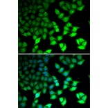 Immunofluorescence - KDM4B antibody from Signalway Antibody (38693) - Antibodies.com