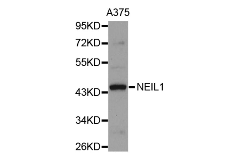 Western blot - NEIL1 antibody from Signalway Antibody (38695) - Antibodies.com