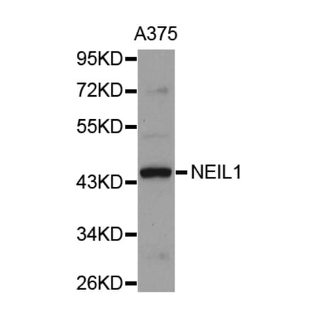 Western blot - NEIL1 antibody from Signalway Antibody (38695) - Antibodies.com