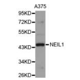 Western blot - NEIL1 antibody from Signalway Antibody (38695) - Antibodies.com