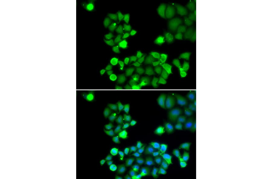 Immunofluorescence - NEIL1 antibody from Signalway Antibody (38695) - Antibodies.com